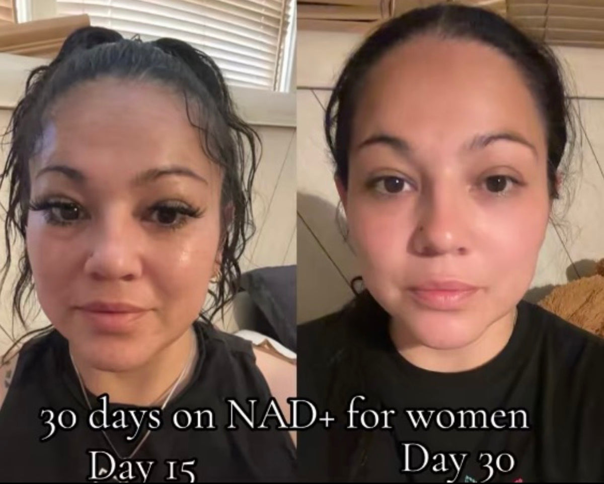 NAD+ | Cellular Energy & Wellness Support